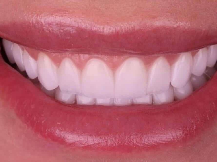 next smile service 2