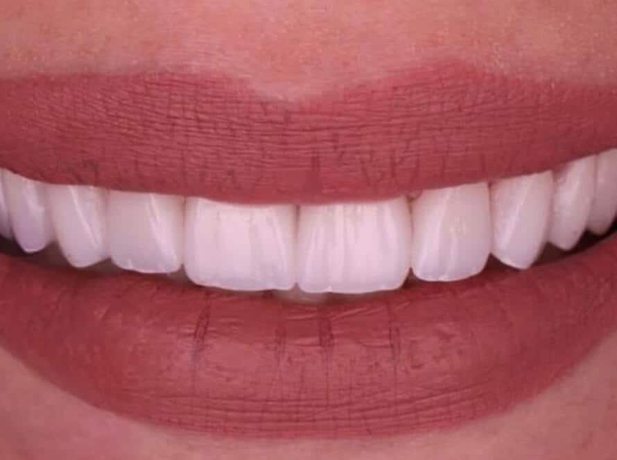 next smile service 3