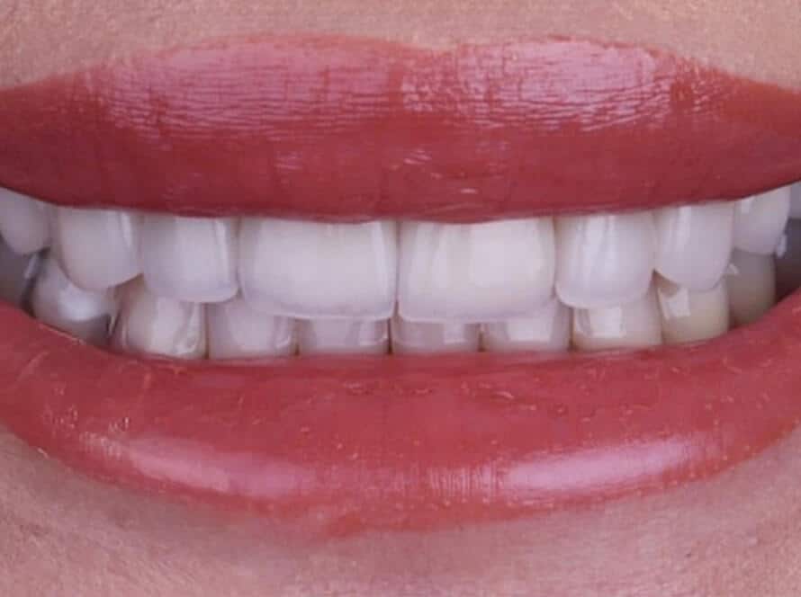 next smile service 5