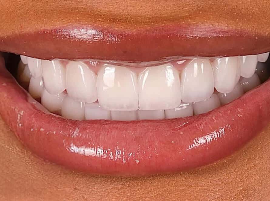 next smile service 6