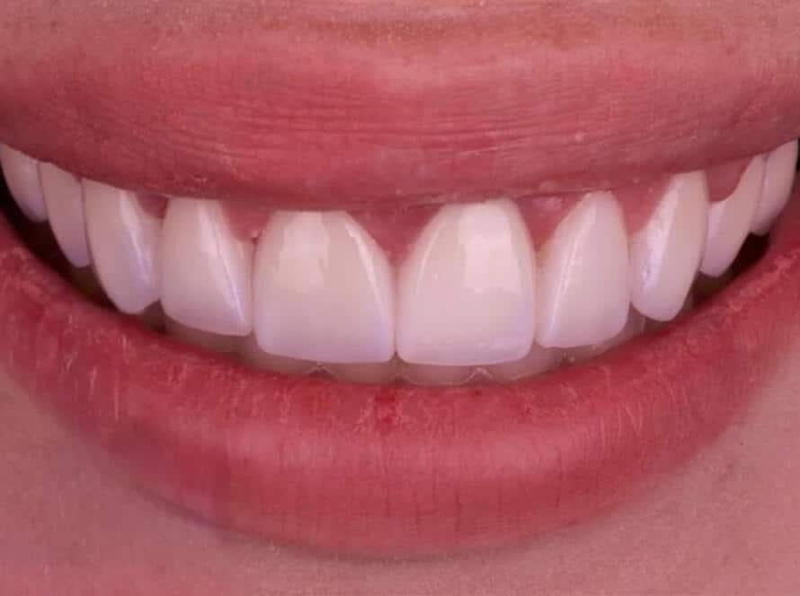 next smile service 7